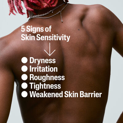 5 Signs of sensitive skin