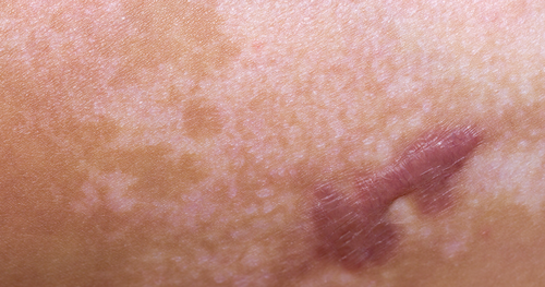 summer sunscreen tips