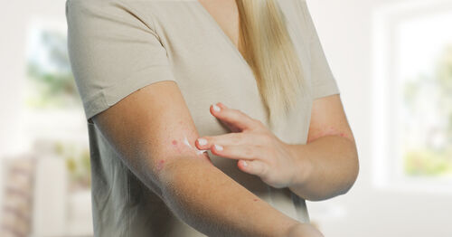 Dry_Skin_Treatment