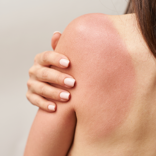 person applying sunscreen to arms and body