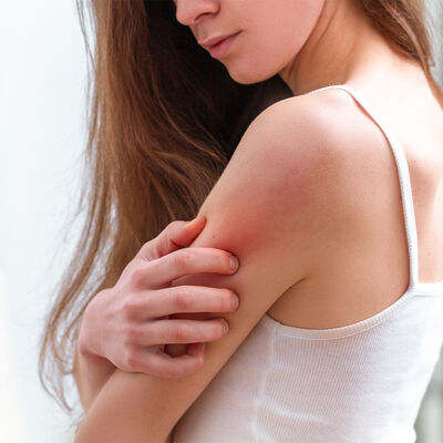 YOUR GUIDE TO SENSITIVE SKIN: CAUSES & SYMPTOMS 