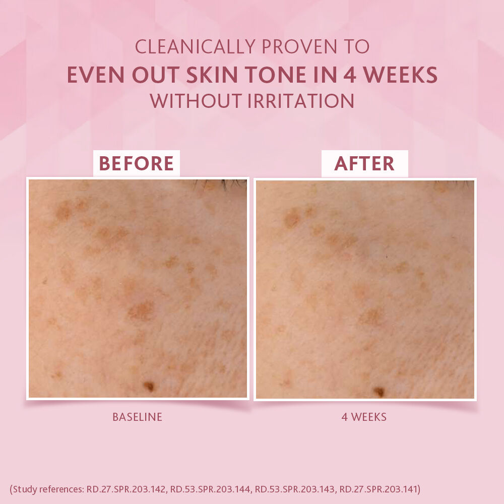 Cetaphil Bright Healthy Radiance Brightening Day Protection Cream SPF15