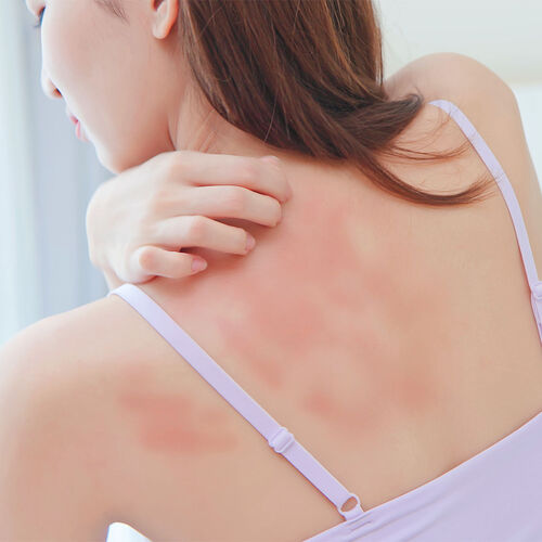 itchy skincare
